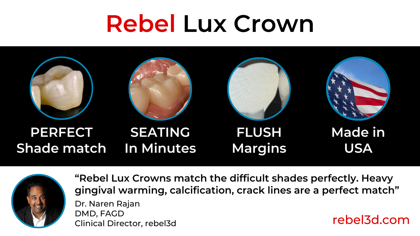 Rebel Lux Crown
